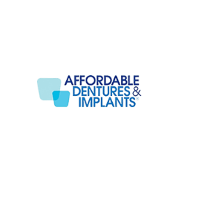 Dental Implants Miami Florida | Miami Lakes Fl